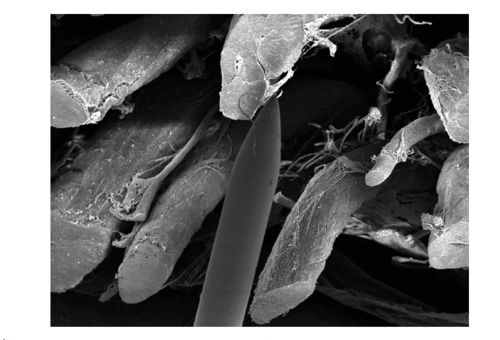 美图收藏贴 椎管内解剖结构精析与针纺织品原料销售指南
